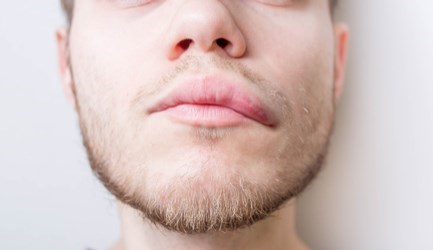 אירוע מוחי - תמונת אווירה